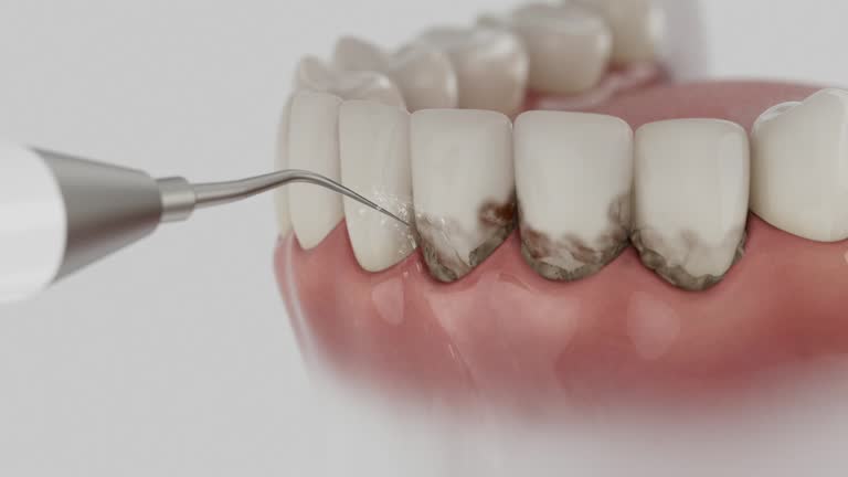 Trusted Dental Implants service in Boston, MA - Dentist Open Now